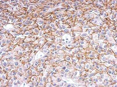 Immunohistochemistry-Paraffin: EDNRB/Endothelin R Type B Antibody [NBP2-16334]