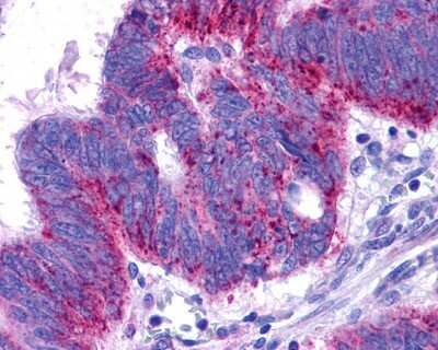 Immunohistochemistry-Paraffin: EDNRB/Endothelin R Type B Antibody - BSA Free [NLS54]