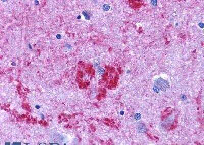 Immunohistochemistry-Paraffin: EDNRB/Endothelin R Type B Antibody - BSA Free [NLS54]