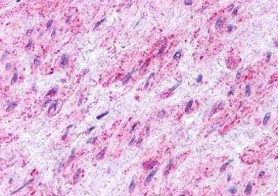 Immunohistochemistry-Paraffin: EDNRB/Endothelin R Type B Antibody - BSA Free [NLS54]