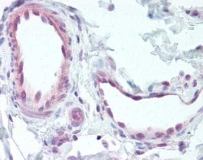 Immunohistochemistry-Paraffin: EDNRB/Endothelin R Type B Antibody - BSA Free [NLS57]