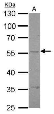 Western Blot: EDNRB/Endothelin R Type B Antibody [NBP1-31108]