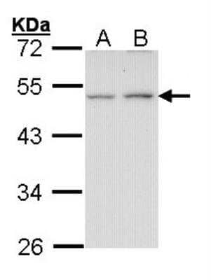 Western Blot: EDNRB/Endothelin R Type B Antibody [NBP2-16335]