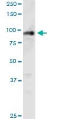 Western Blot: EDR1/PHC1 Antibody (3G1) [H00001911-M05]