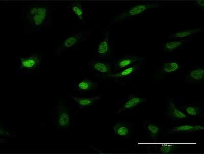 Immunocytochemistry/ Immunofluorescence: EDR1/PHC1 Antibody [H00001911-B01P]