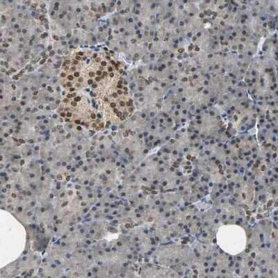 Immunohistochemistry-Paraffin: EDR1/PHC1 Antibody [NBP1-84009]