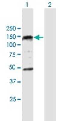 Western Blot: EDR1/PHC1 Antibody [H00001911-B01P]