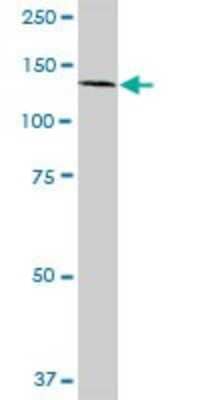 Western Blot: EDR1/PHC1 Antibody [H00001911-D01P]