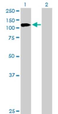 Western Blot: EDR1/PHC1 Antibody [H00001911-D01P]