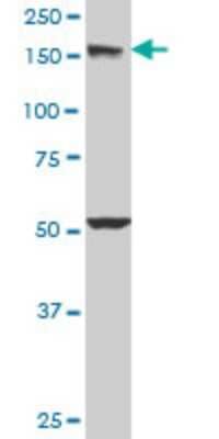 Western Blot: EEA1 Antibody (2G2) [H00008411-M03]