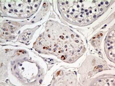 Immunohistochemistry: EEA1 Antibody (6D4.1D4) - Azide and BSA Free [NBP2-80711]