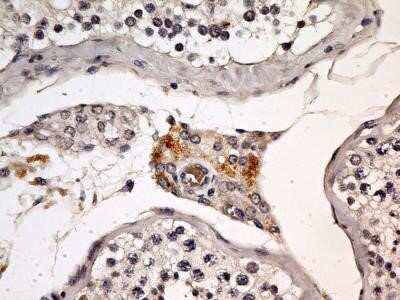 Immunohistochemistry-Paraffin: EEA1 Antibody (6D4.1D4) - Azide and BSA Free [NBP2-80711]