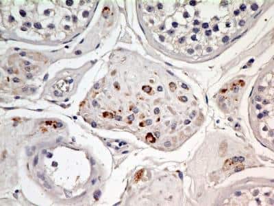 Immunohistochemistry-Paraffin: EEA1 Antibody (6D4.1D4) - BSA Free [NBP2-36568]
