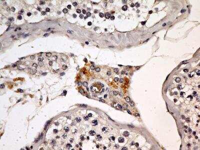 Immunohistochemistry-Paraffin: EEA1 Antibody (6D4.1D4) - BSA Free [NBP2-36568]