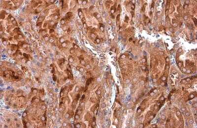 Immunohistochemistry-Paraffin: EEA1 Antibody (GT10811) [NBP3-13599]
