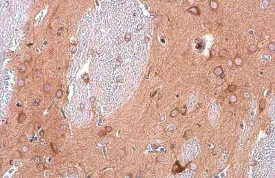 Immunohistochemistry-Paraffin: EEA1 Antibody (GT10811) [NBP3-13599]