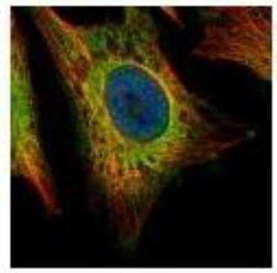 Immunocytochemistry/ Immunofluorescence: EEA1 Antibody [NBP1-30914]