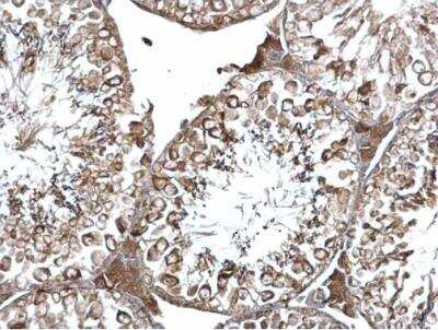 Immunohistochemistry-Paraffin: EEA1 Antibody [NBP1-30914]