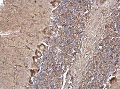 Immunohistochemistry-Paraffin: EEA1 Antibody [NBP1-30914]