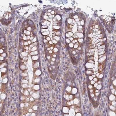 Immunohistochemistry-Paraffin: EEA1 Antibody [NBP1-91860]