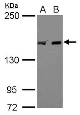Western Blot: EEA1 Antibody [NBP1-30914]