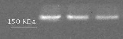 Western Blot: EEA1 Antibody [NBP1-30914]