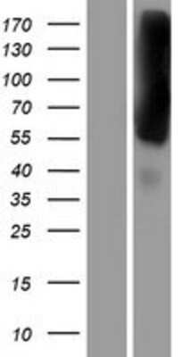 Western Blot: EEA1 Overexpression Lysate [NBP2-07982]