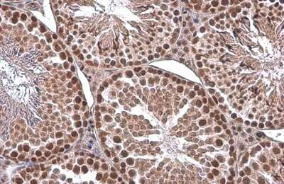 Immunohistochemistry-Paraffin: EED Antibody (GT885) [NBP3-13628]