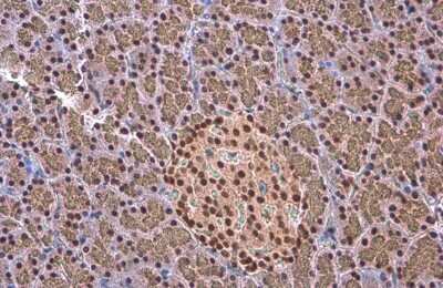 Immunohistochemistry-Paraffin: EED Antibody (GT885) [NBP3-13628]