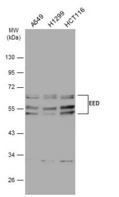 Western Blot: EED Antibody (GT885) [NBP3-13628]