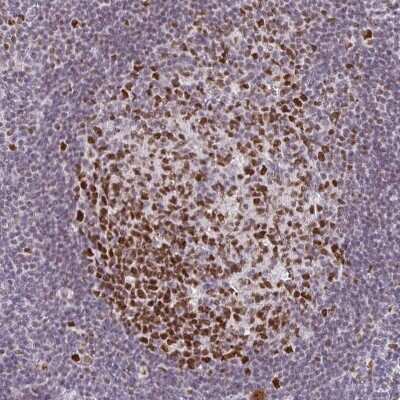 Immunohistochemistry-Paraffin: EED Antibody [NBP2-38907]