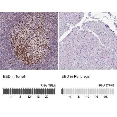 Immunohistochemistry-Paraffin: EED Antibody [NBP2-38907]