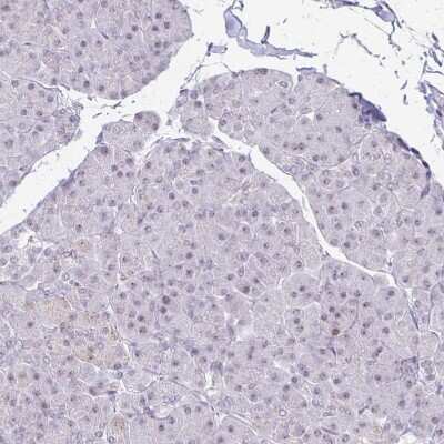 Immunohistochemistry-Paraffin: EED Antibody [NBP2-38907]