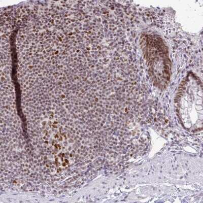 Immunohistochemistry-Paraffin: EED Antibody [NBP2-38907]