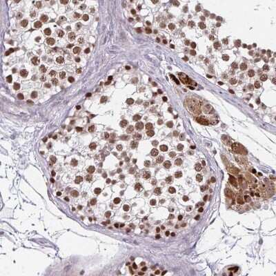 Immunohistochemistry-Paraffin: EED Antibody [NBP2-38907]
