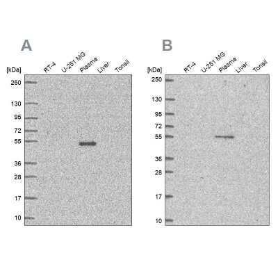 Western Blot: EED Antibody [NBP2-38907]