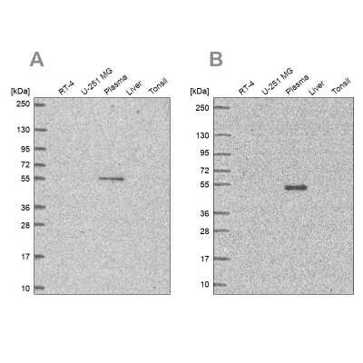 Western Blot: EED Antibody [NBP2-57195]