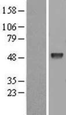 Western Blot: EED Overexpression Lysate [NBL1-10119]