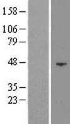 Western Blot: EED Overexpression Lysate [NBL1-10120]