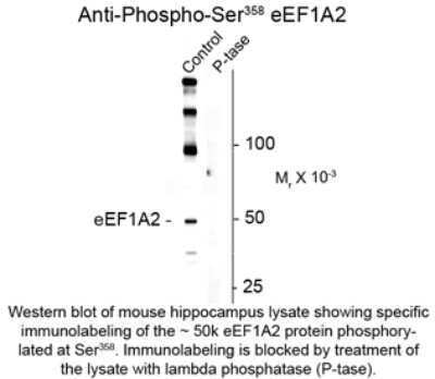 Western Blot: EEF1A2 [p Ser358] Antibody [NBP2-29510]