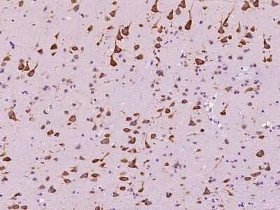 Immunohistochemistry-Paraffin: EEF1A2 Antibody [NBP2-97554]