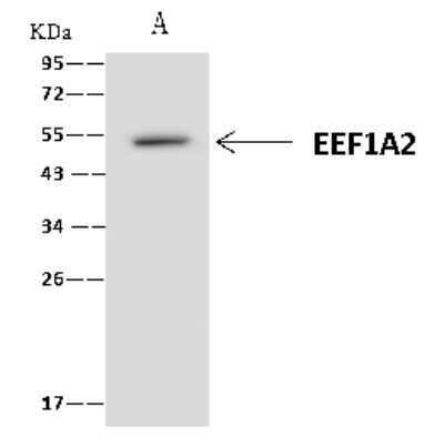 Immunoprecipitation: EEF1A2 Antibody [NBP2-97554]