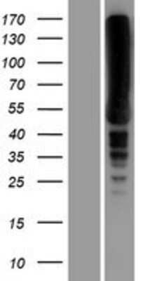 Western Blot: EEF1A2 Overexpression Lysate [NBP2-08158]