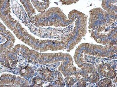 Immunohistochemistry-Paraffin: EEF1B2 Antibody [NBP1-31611]