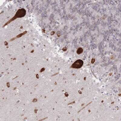 Immunohistochemistry-Paraffin: EEF1B2 Antibody [NBP2-37875]