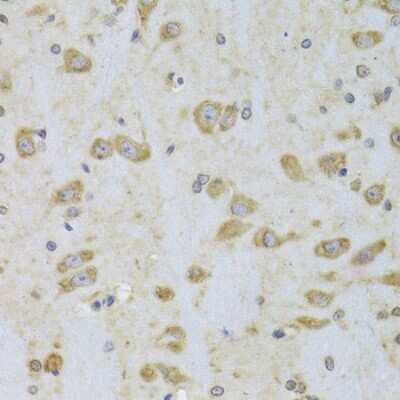 Immunohistochemistry-Paraffin: EEF1B2 Antibody - BSA Free [NBP2-92964]