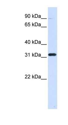 Western Blot: EEF1B2 Antibody [NBP1-53035]