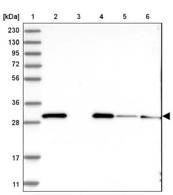 Western Blot: EEF1B2 Antibody [NBP2-37875]