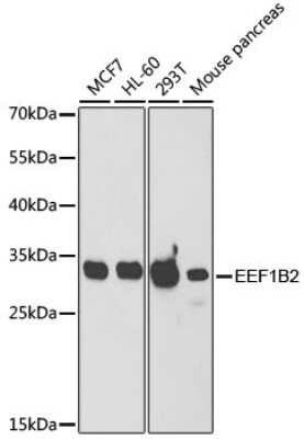 Western Blot: EEF1B2 AntibodyBSA Free [NBP2-92964]