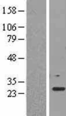 Western Blot: EEF1B2 Overexpression Lysate [NBL1-10122]